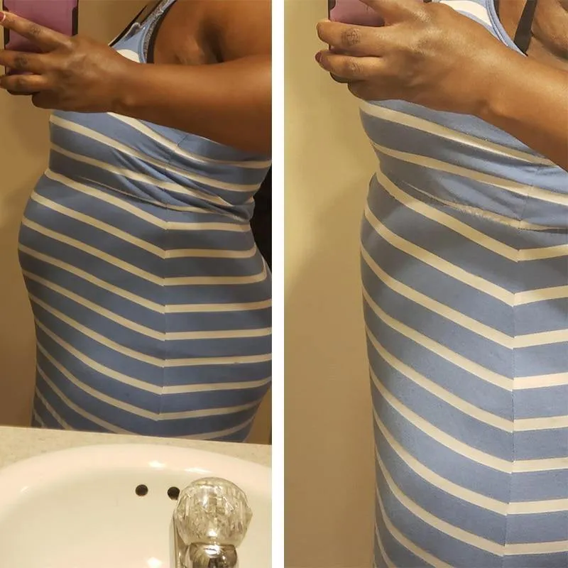 Post Surgery Girdle Slimming Butt Lifter Shapewear